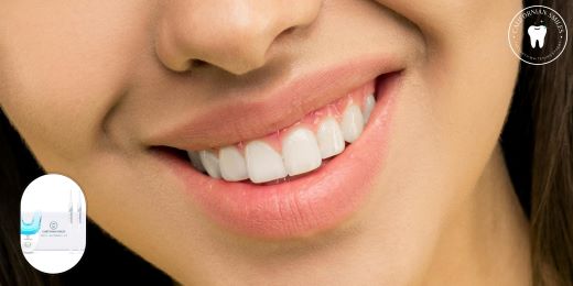What is the best method for tooth whitening without risk for enamel?