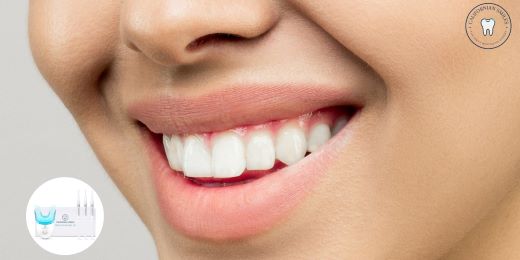 What results can we expect from a teeth whitening kit?