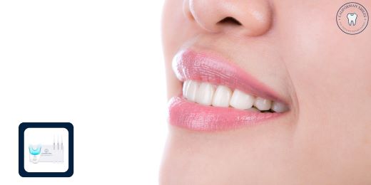 Are the results of teeth whitening with a kit permanent?