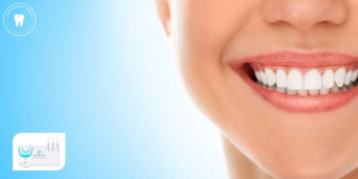 What are the tips for choosing a dental whitening kit?