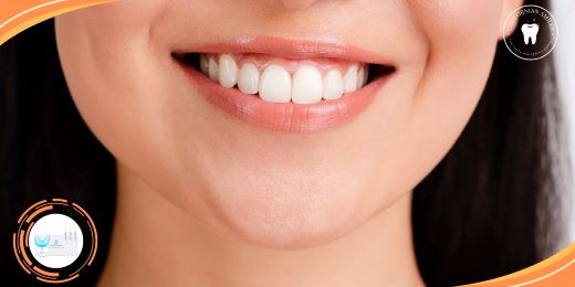 Are teeth whitening kits suitable for teenagers?