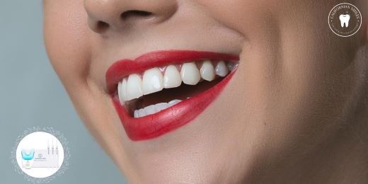 How many times a week can I use a teeth whitening kit?