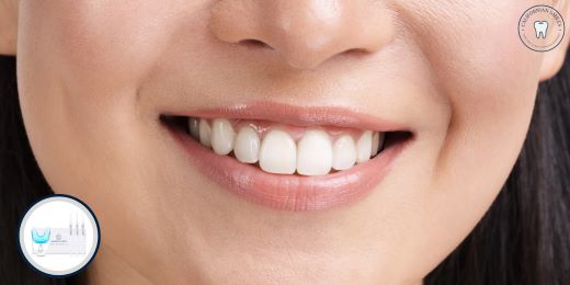How to use a teeth whitening kit?