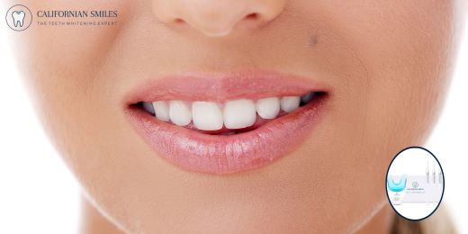 How to properly store your teeth whitening kit to ensure its durability?