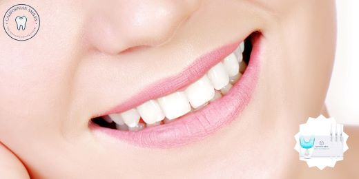 How to choose the right time to start a tooth whitening treatment?