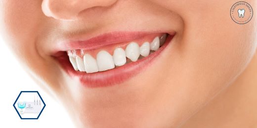 How do you know if a teeth whitening kit is genuine and safe?