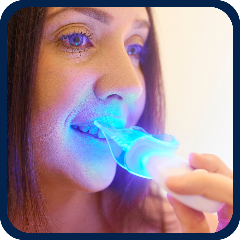 Teeth Whitening